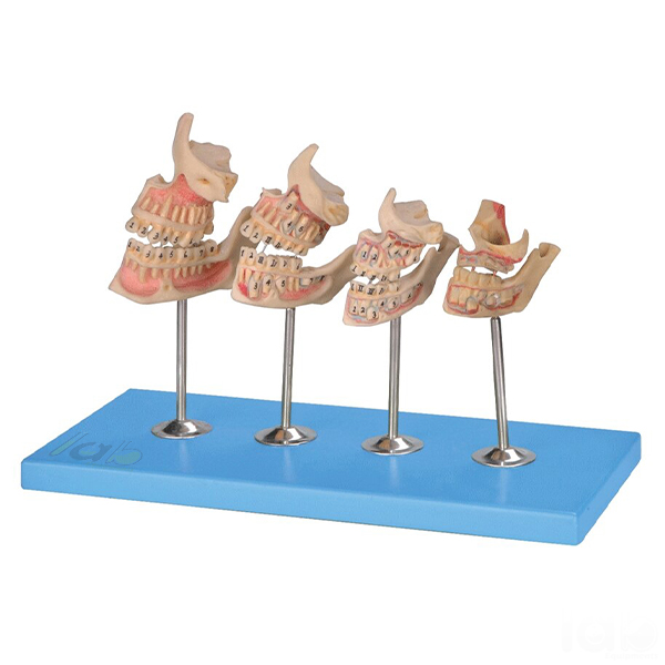 Human Teeth Model, Dentition Development